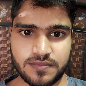 Atul - Accounting tutor - 